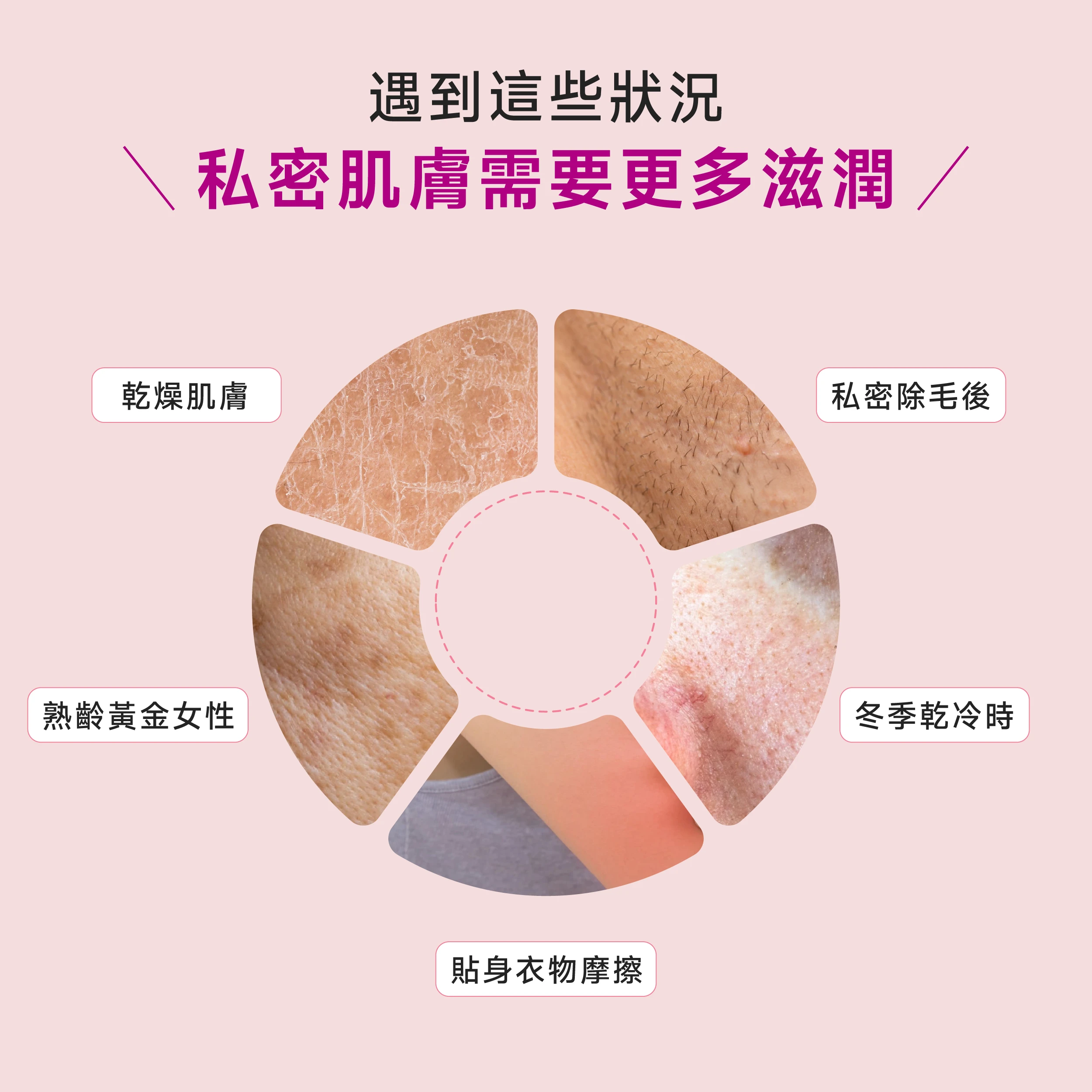 私密除毛後、冬季乾冷時、乾燥肌膚族群、熟齡黃金女性、貼身衣物摩擦，遇到這些狀況肌膚需要更多的滋潤調理