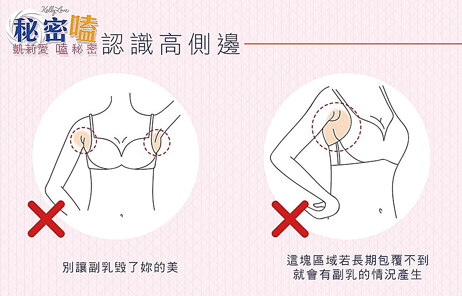 認識內衣高側邊|凱莉愛內衣版型與穿著示意