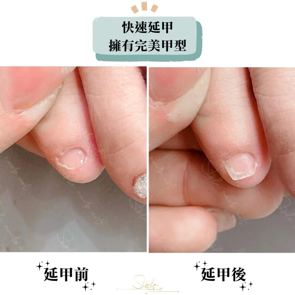 免刻磨腳甲片