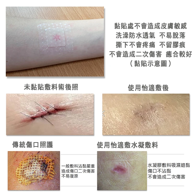 怡適敷EASTDERM -水凝膠傷口敷料(110mm x 60mm)