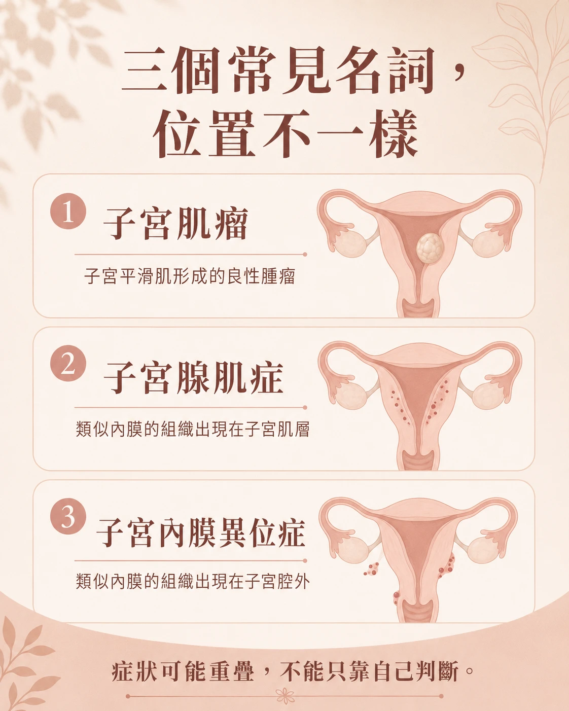 子宮肌瘤、子宮腺肌症與子宮內膜異位症位置與概念比較